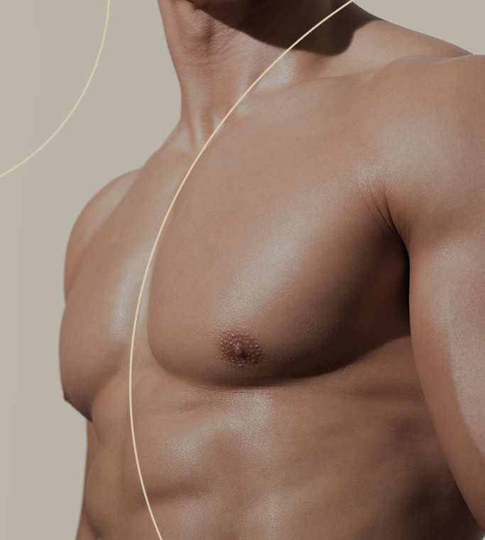 Our Male Breast Reduction Techniques